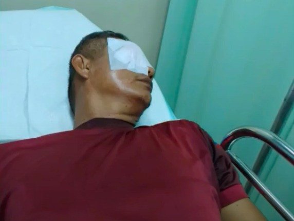 2 Versi Berbeda Kronologi Guru Dianiaya Wali Murid Gunakan Ketapel