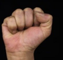 Diduga Dianiaya Guru, Siswa SD Alami Luka di Dada dan Pinggang