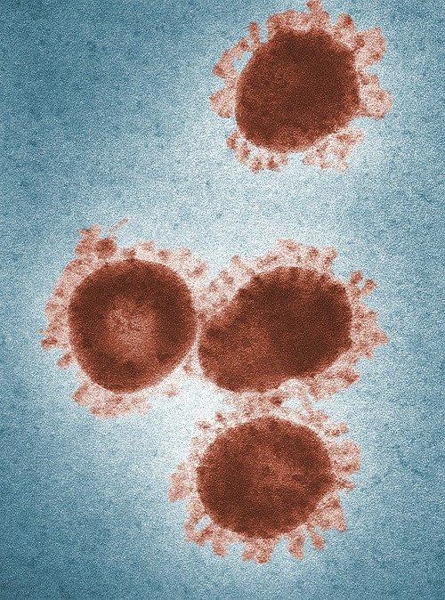 Mengenal Apa Itu Virus Cacar Monyet, Gejala Serta Cara Penularannya